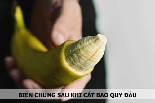 Cắt Bao Quy Đầu Có Gây Nhiễm Trùng Không ĐakLak Cắt Bao Quy Đầu Có Gây Nhiễm Trùng Không ĐakLak