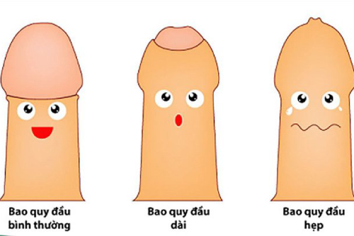 Hình Ảnh Viêm Bao Quy Đầu Giai Đoạn Đầu Pleiku Gia Lai